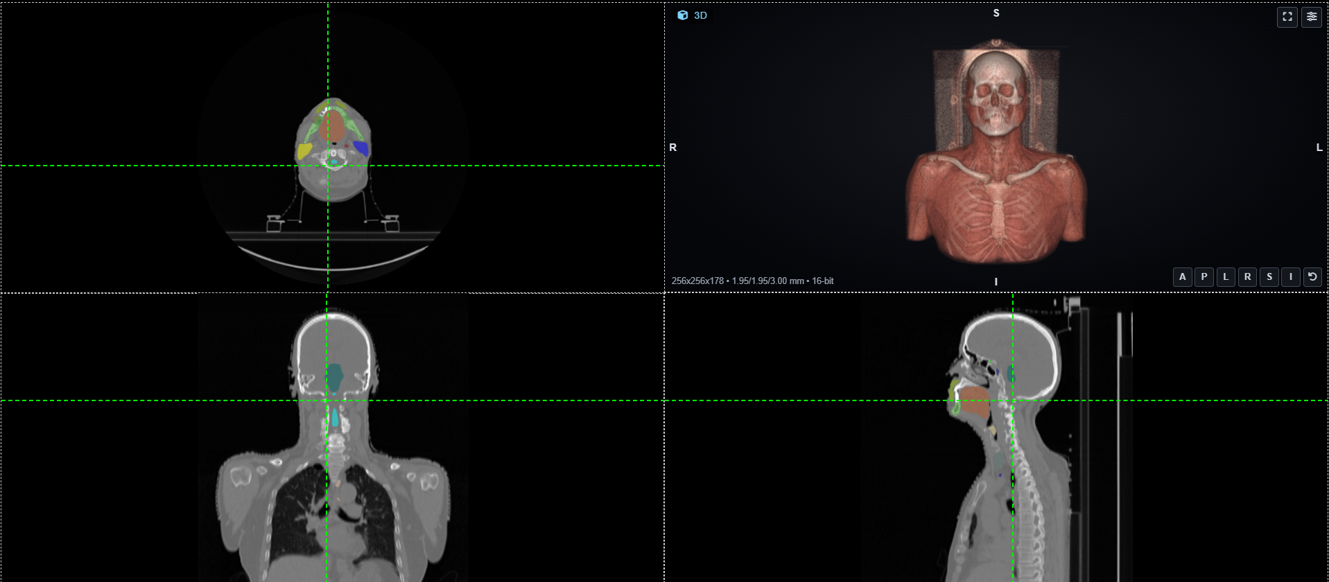 ImagiXAI AI Connected Care — shared imaging study across the care team