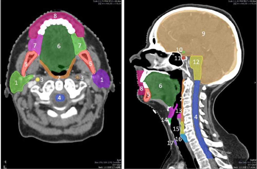 ImagiXAI automatic segmentation of head and neck organs at risk on a CT scan