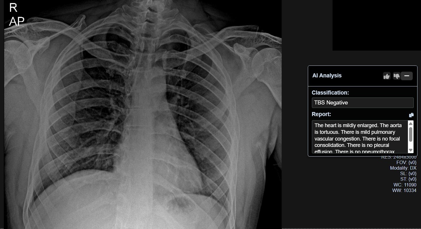 ImagiXAI AI-generated chest X-ray analysis and report